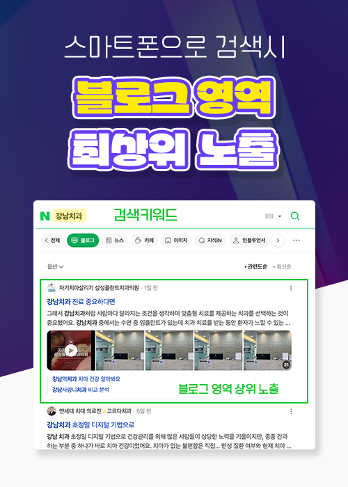 광고서비스